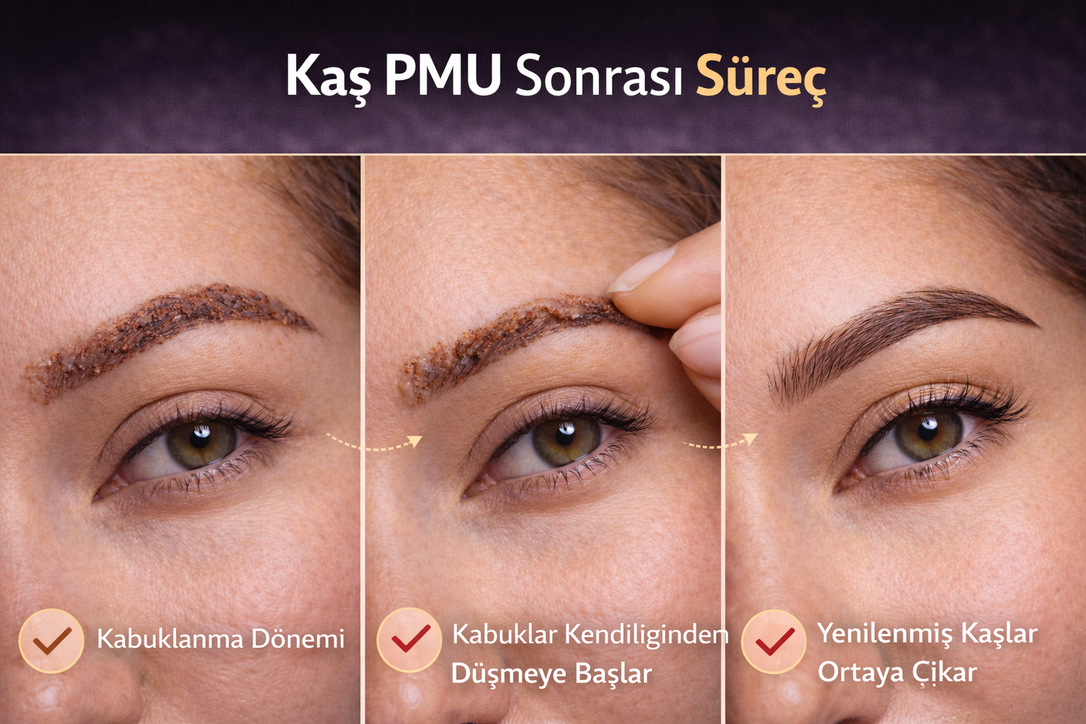 Kaş Pmu Sonrası Kabuklanma Normal mi? Süreç Nasıl Olmalı?