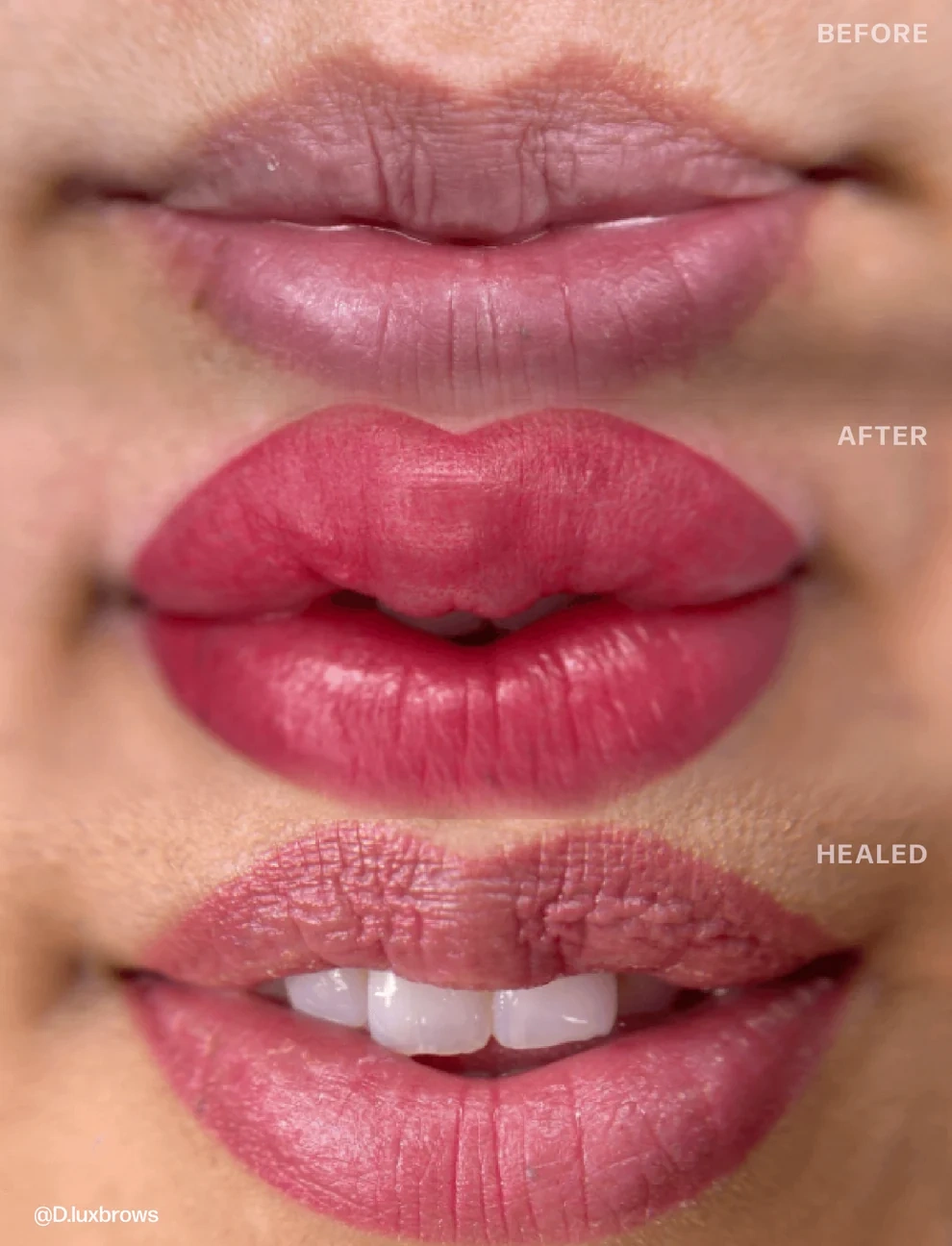 Perma Blend Sultry Lip Raspberry Kırmızı-Pembe Dudak Pigmenti 15ml Perma Blend Sultry Lip Raspberry Kırmızı-Pembe Dudak Pigmenti 15ml